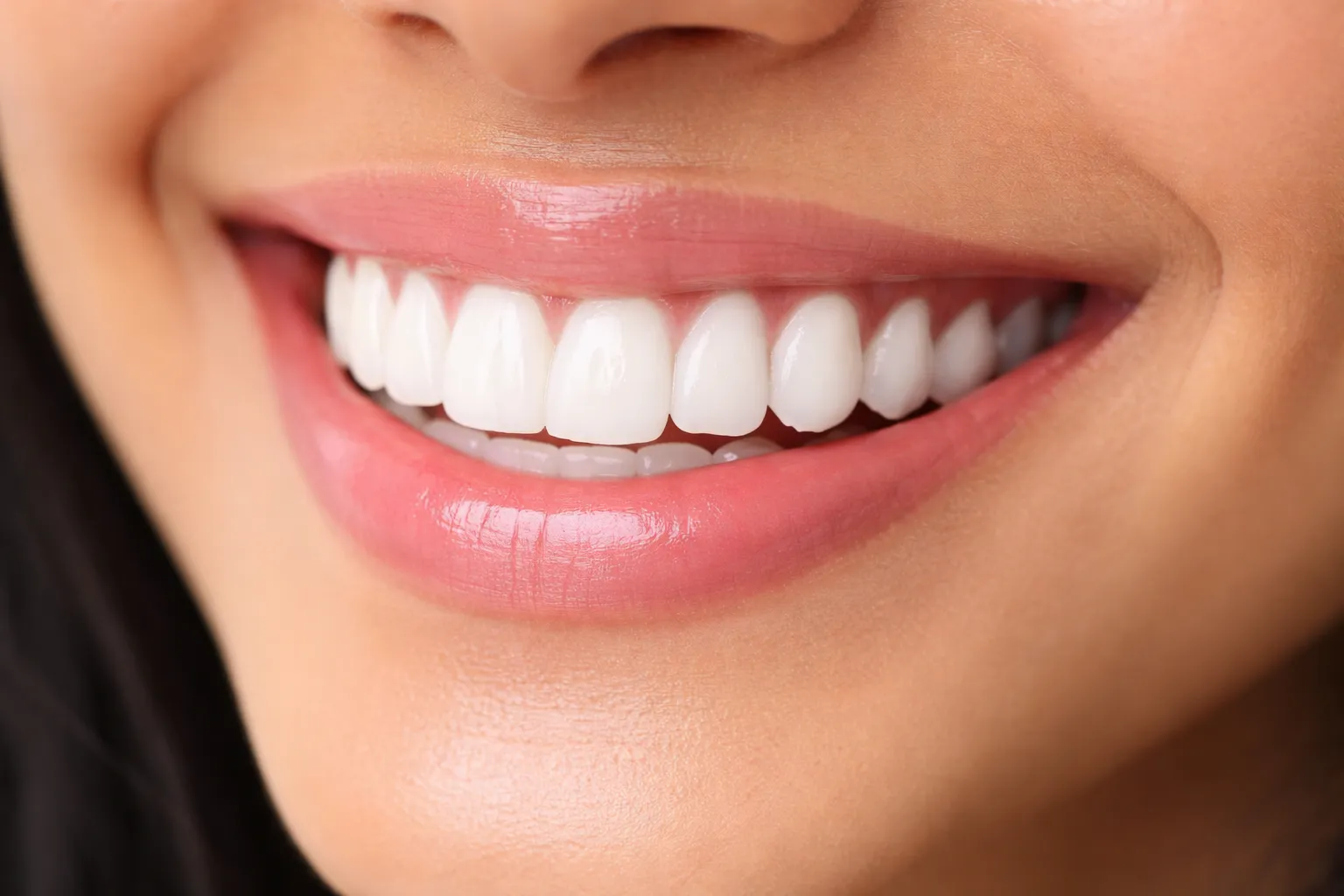 Beautiful healthy smile — Tooth District cosmetic dentistry result
